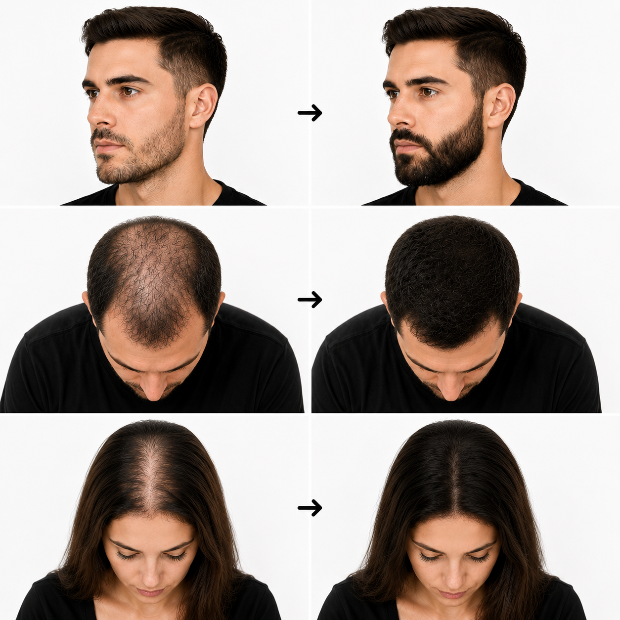 Hair Sculpt - Crema Correctora de Densidad Capilar